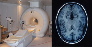 Magnetic Resonance Imaging